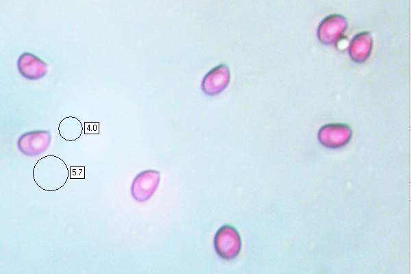 Spores of Fistulina hepatica